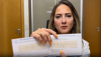 EXTRASÍSTOLE? Dra. Natália explica no detalhe