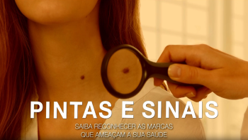Pintas e Sinais, um charme? Nem sempre!