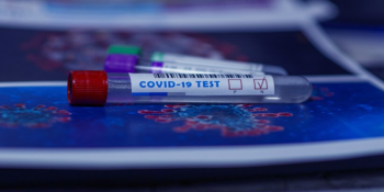 Origem da COVID-19: Cientistas Identificam Novos Suspeitos no Mercado de Wuhan