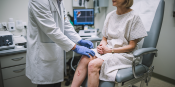 Inflamação Vascular: Sintomas, Causas e Tratamentos Precoce