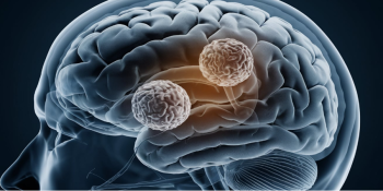 Câncer vs. Tumor: Conhecendo as Diferenças Cruciais