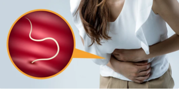 Descubra se Você Tem Sinais de Vermes no Corpo: Como Identificar e Tratar