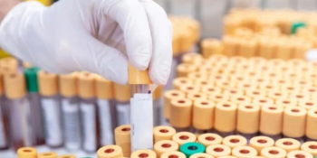 Laboratório Australiano Perde 323 Frascos de Vírus Mortais: Uma Falha Crítica de Biossegurança