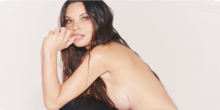 Foto: instagram.com/SKIMS Olivia Munn mostrou cicatrizes após mastectomia