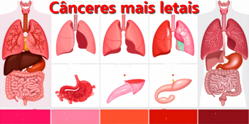 Cânceres Mais Mortais: Quais Matam Mais Rápido e Como se Proteger