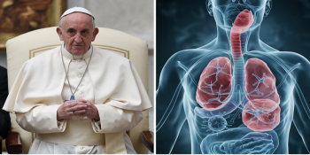 O Desafio das Infecções Polimicrobianas: O Caso do Papa Francisco