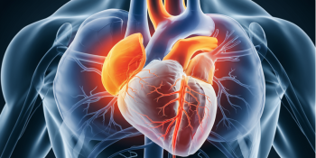 Miocardiopatia Dilatada: O Que Você Precisa Saber sobre Causas, Sintomas e Tratamento