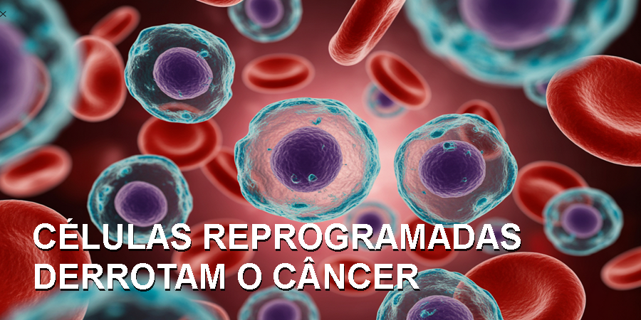 Pesquisadores do Institut Pasteur e do Inserm desenvolveram uma terapia tripla capaz de eliminar a leucemia em modelo pré-clínico, reprogramando a morte das células cancerígenas.
